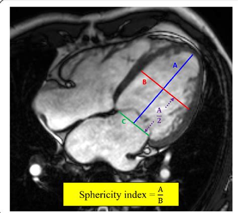 lv sphericity index calculation|Prognostic Value of Resting Left Ventricular Sphericity Indexes in .